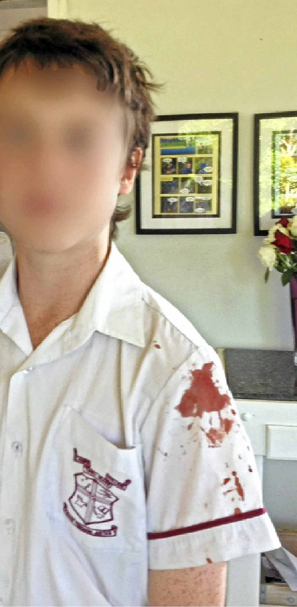 St Joseph’s College Year 8 student Lachlan Raferty was stabbed with a pen by a classmate during school recess. St Joseph’s College Year 8 student Lachlan Raferty was stabbed with a pen by a classmate during school recess.